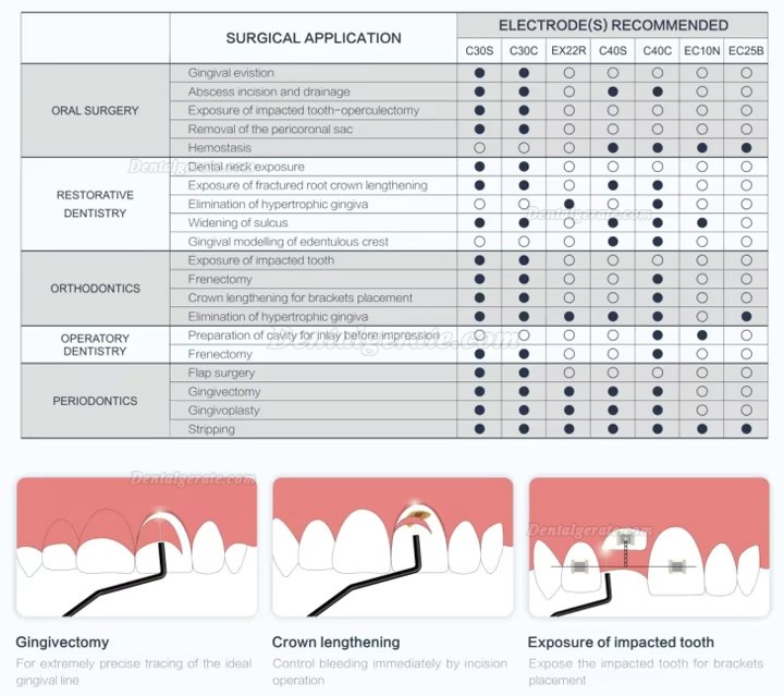 Dentales Elektrokautersystem Tragbares Elektrochirurgieger&auml;t ES-01